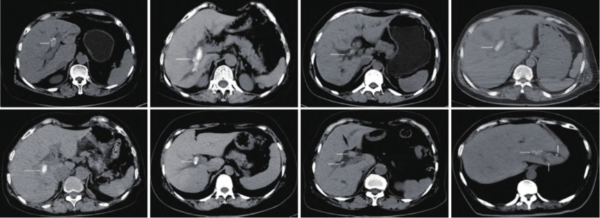 1761028696537736.png 640.png